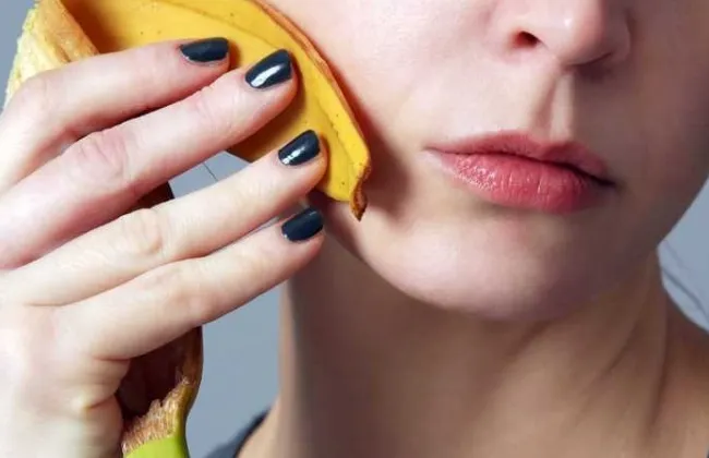 فوائد قشر الموز للوجه والبشرة في علاج التصبغات