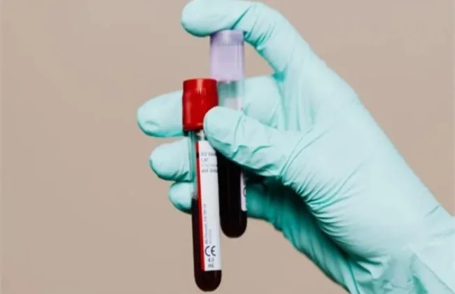  اختراق طبي.. فحص دم جديد يتنبأ بمرض الزهايمر قبل ظهور أعراضه بـ 20 عاماً