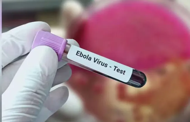 الصحة العالمية: تعزيز مكافحة تفشى إيبولا فى كينيا بعد تأكيد أول إصابة